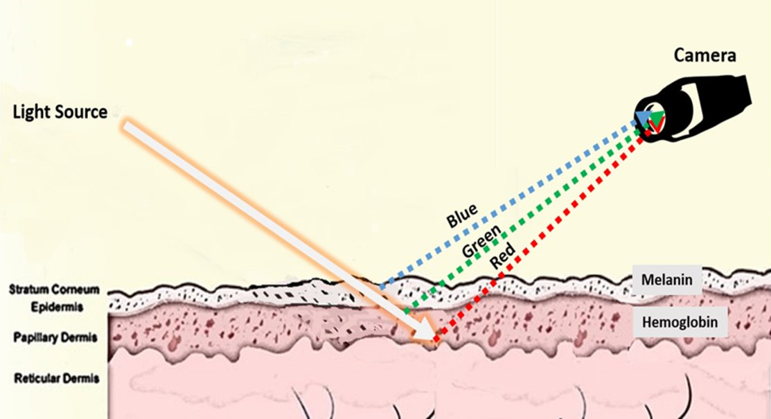 Transdermal Optical Imaging (TOI)